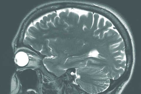 Kiwis propel portable MRI development