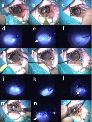Macula implant eye changes-artificial-retina-study.jpg