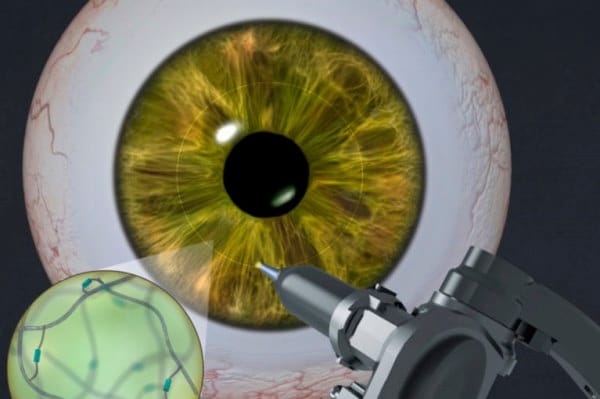Adhesive gel for corneas