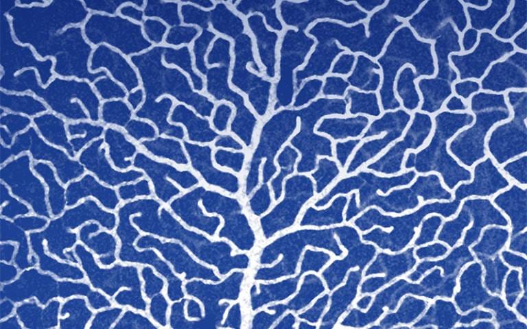 microvascular tree