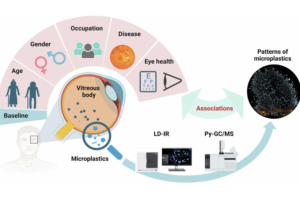Microplastics found in human vitreous