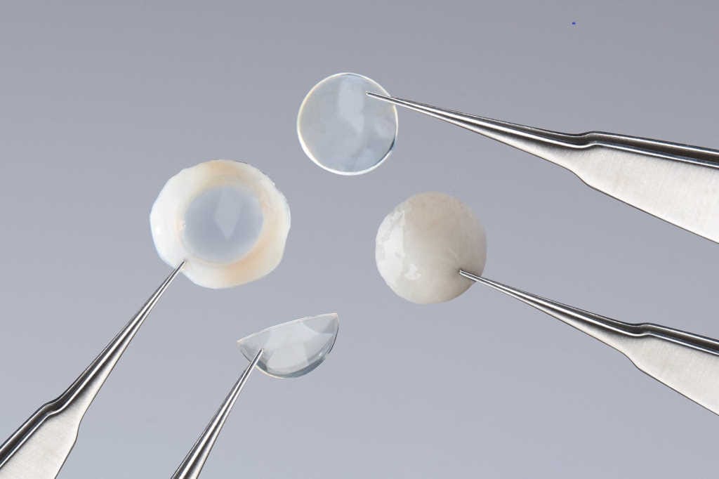 Long shelf-life corneas now in NZ