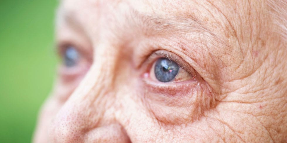 RANZCO launches Kiwi’fied AMD guidelines