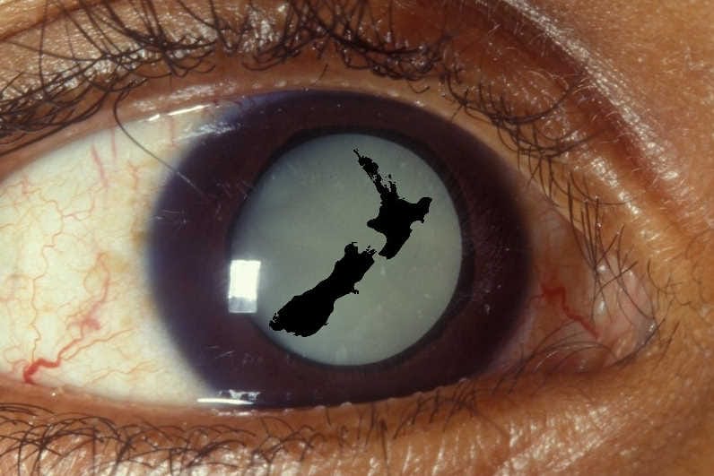 Government tackles cataract ‘postcode lottery’?