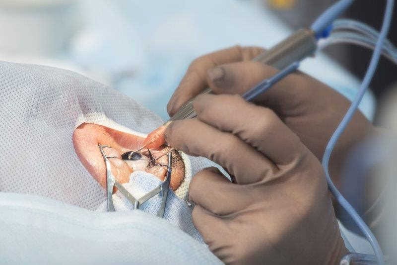 Battling for better eye care in NZ