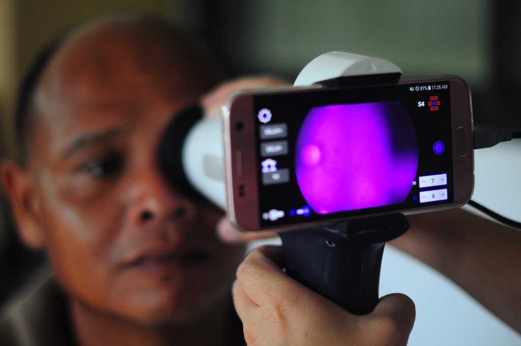 Teleophthalmology tech goes global