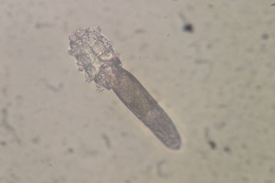 eye on ophtho demodex fig 1