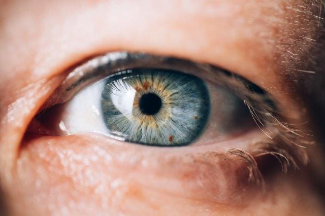 Myopia’s impact on sclera shape