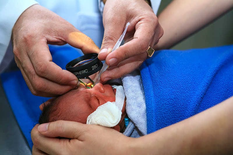 Research enables safer test for blindness in preterm babies