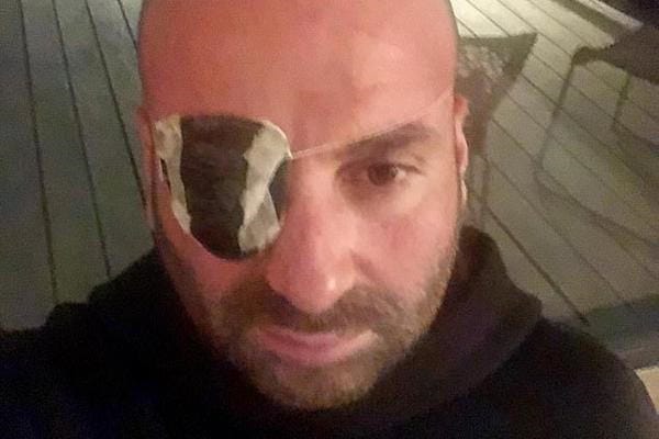 Stars and their eyes George Calombaris