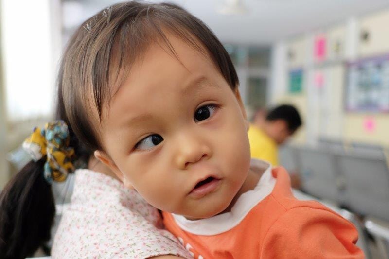 Strabismus linked to mental illness (1)