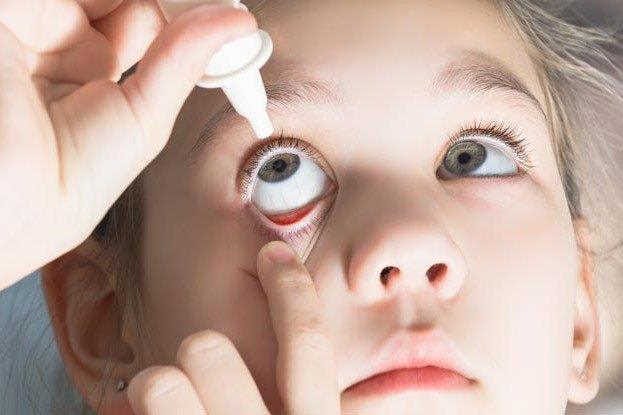 Dry eye prevalent in healthy children