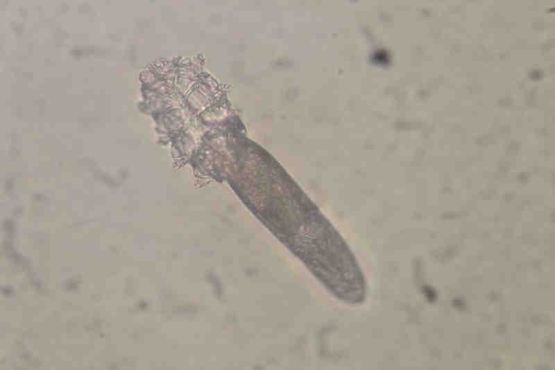 Demodex: the mighty mite or pesky parasite?