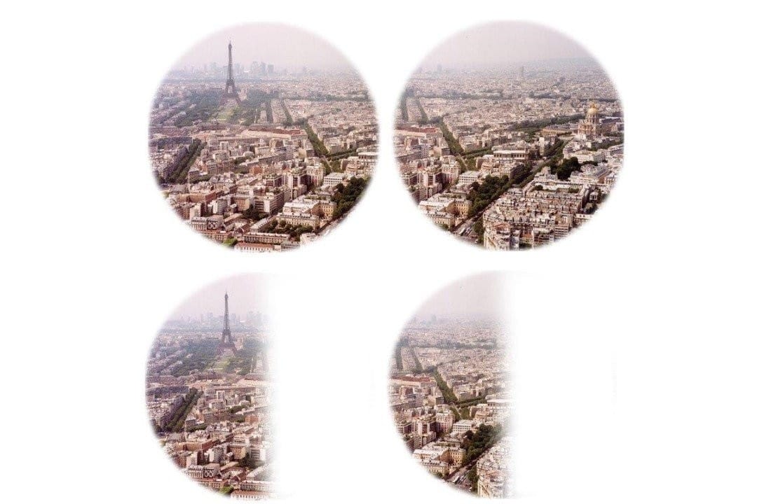 Case study: The reality beyond cataract surgery