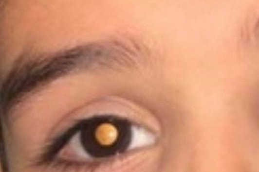 Stars and their eyes…Know the glow campaign
