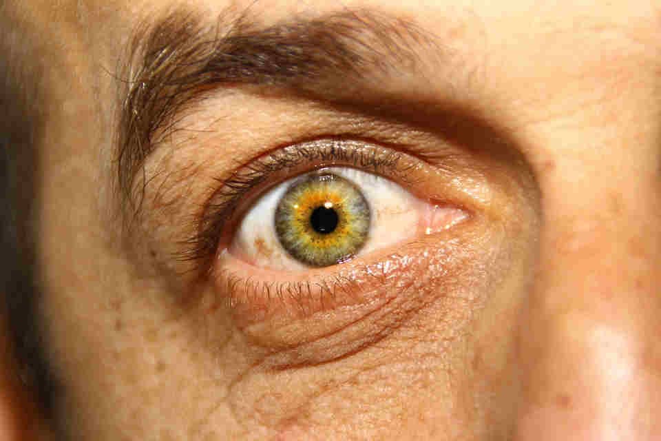 VIP treatment for corneal transplants