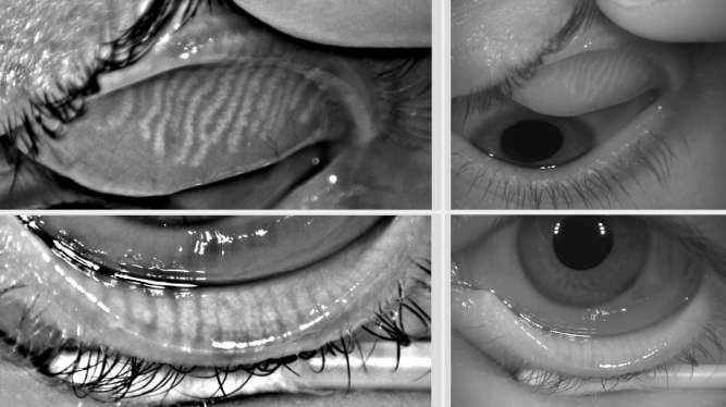 Blinking and the tear film