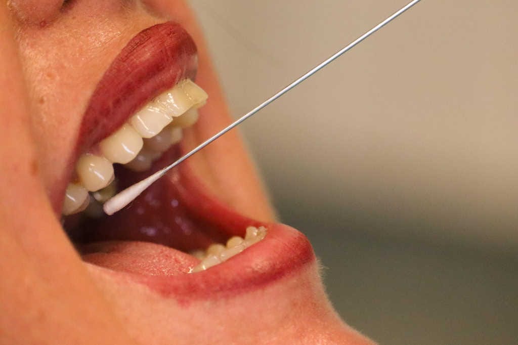 Saliva test for glaucoma risk by year’s end