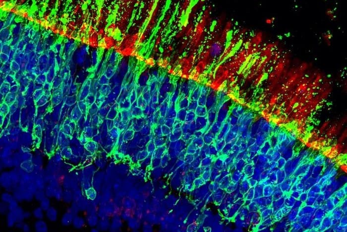 dfuhexbz iob human retinal organoid online