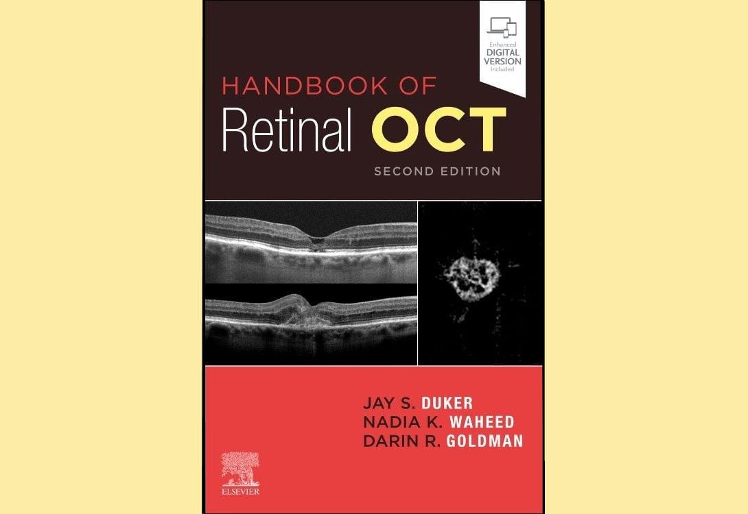 BOOK REVIEW: Handbook of Retinal OCT (second edition) by Jay Duker, Nadia Waheed and Darin Goldman