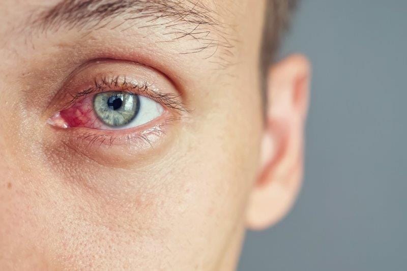 Uveitis research review