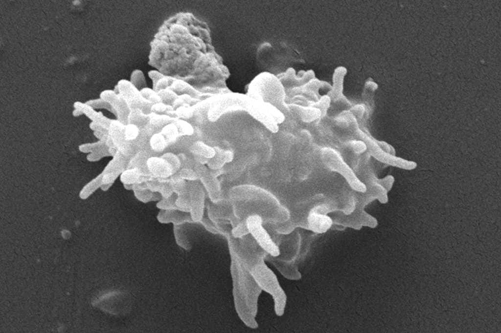 Acanthamoeba vs CL disinfection
