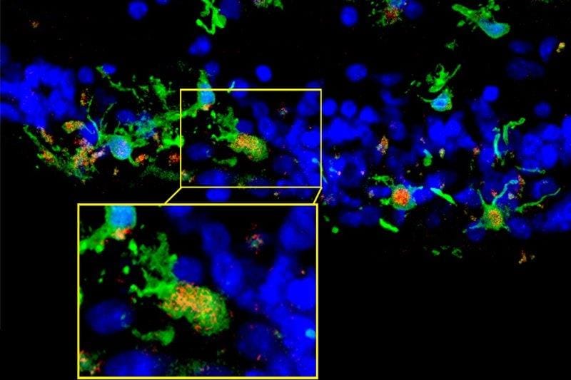 jCell IVT shows promise for RP