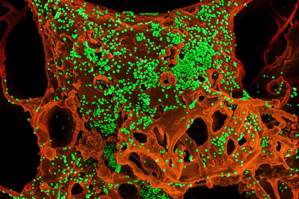 Coronavirus postpones APAO