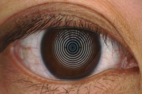 Identifying inflammation in dry eye disease