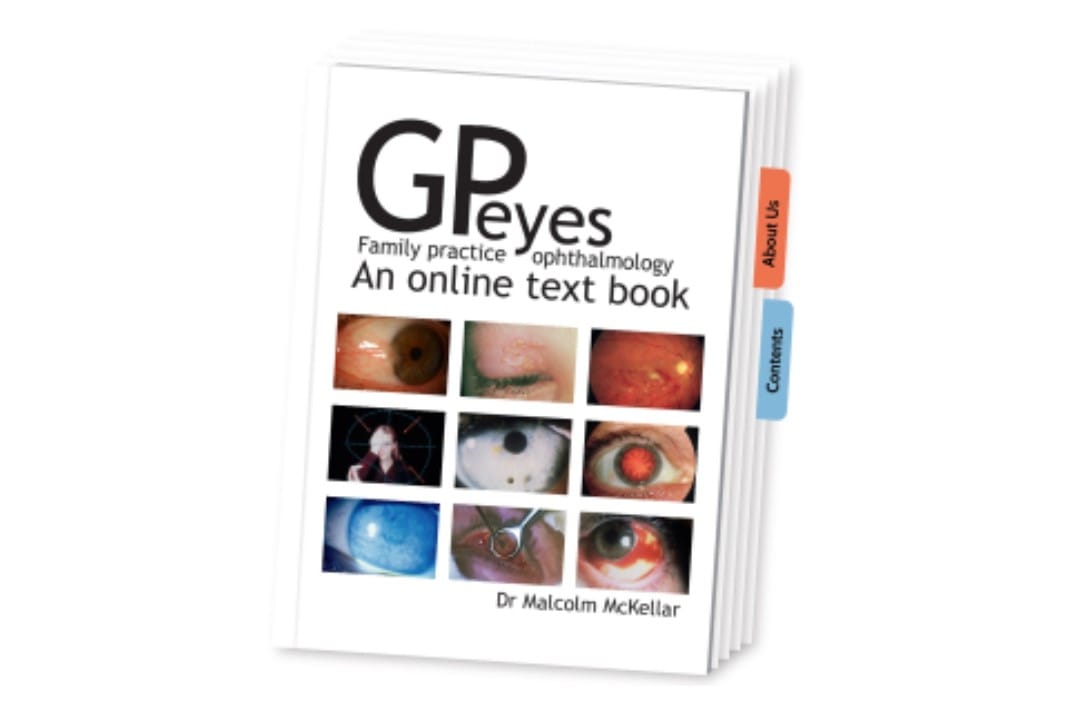 Free GP resource for common eye concerns