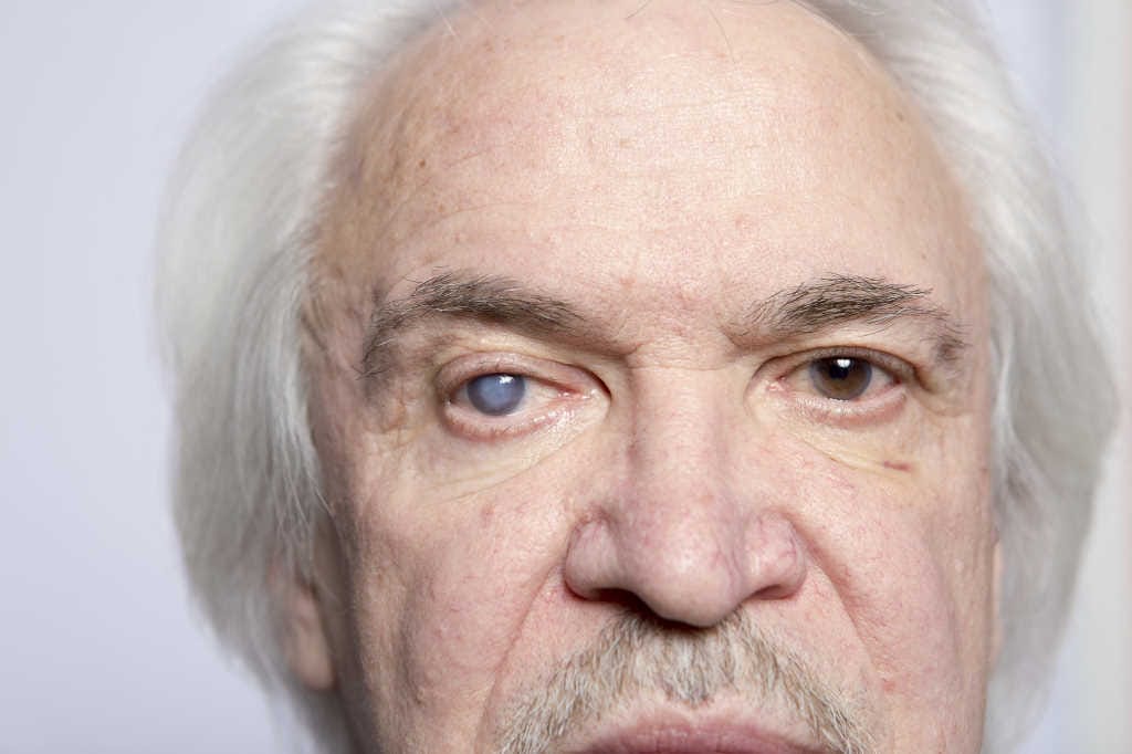 Anti-cataract implant study underway