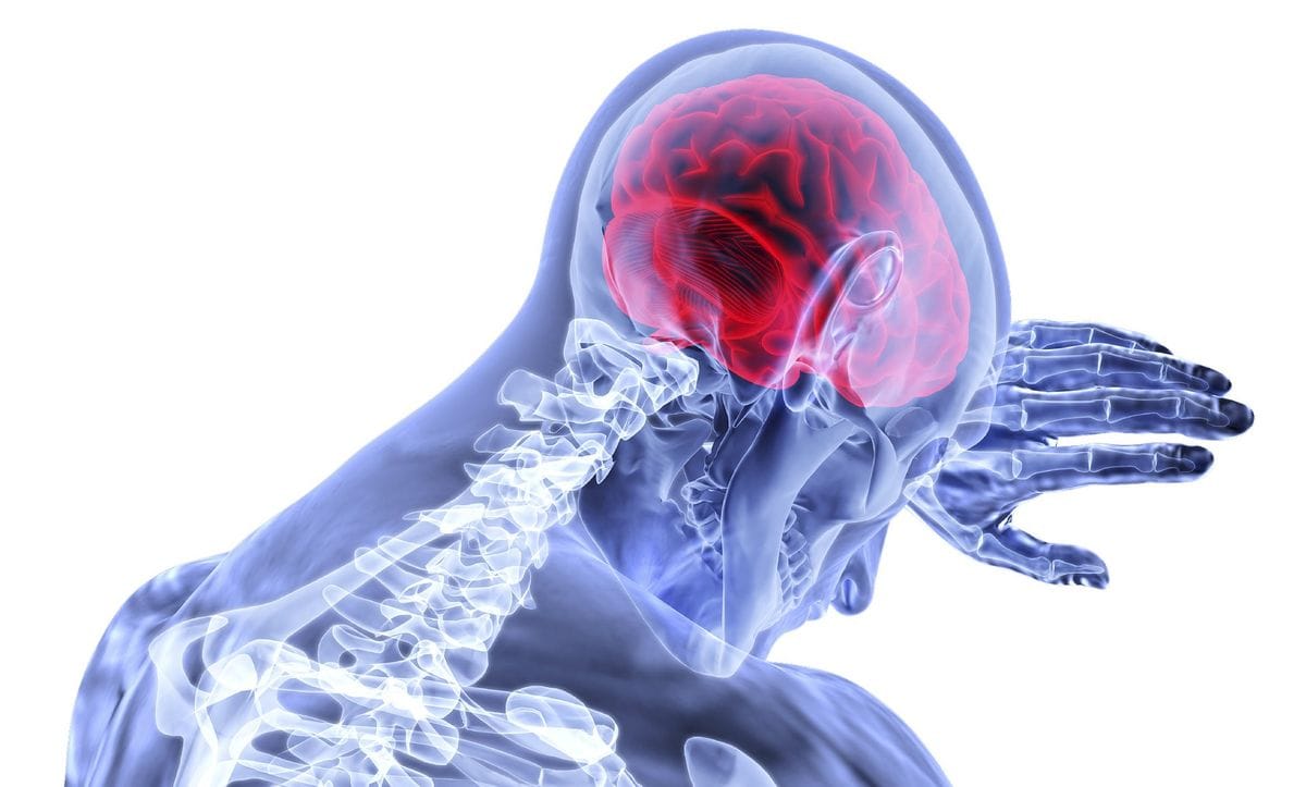 Auckland University concussion app mooted