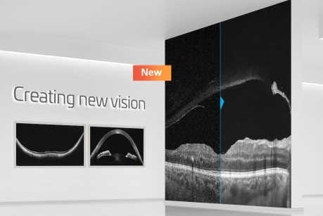 Revo OCT gets software boost