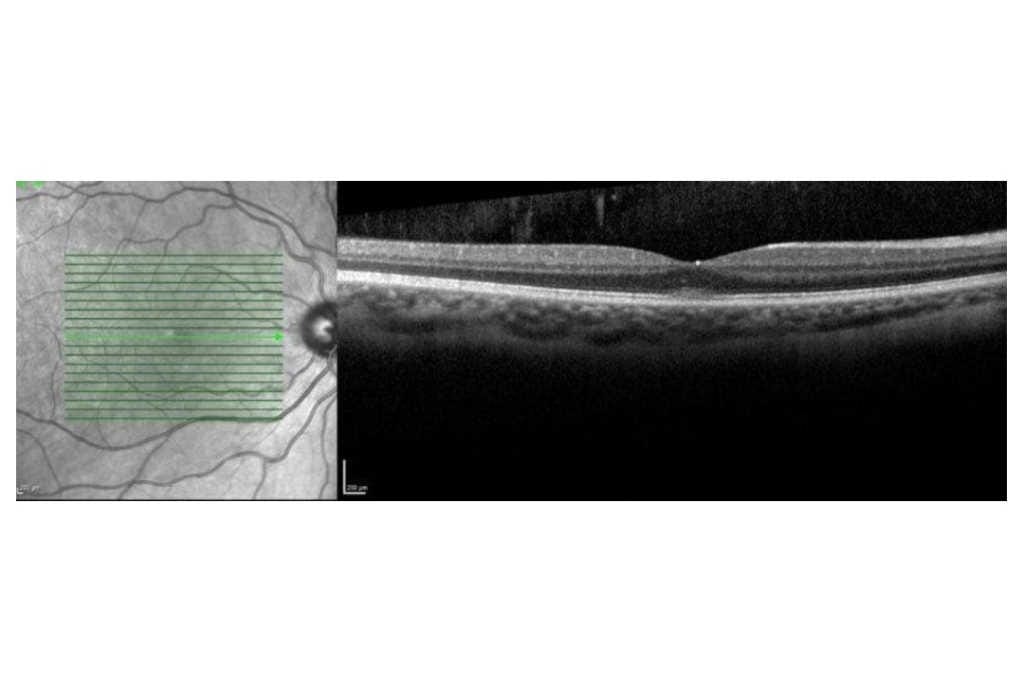 CASE STUDY: For eyes that really pop…