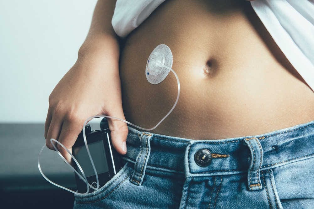 Insulin pumps lower DR risk?