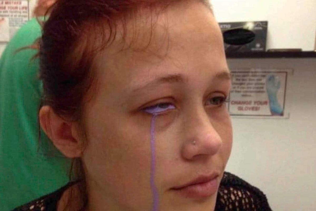 Kiwis join call to ban eyeball tattoos