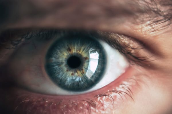 Late phase II trials for Nyxol eyedrop