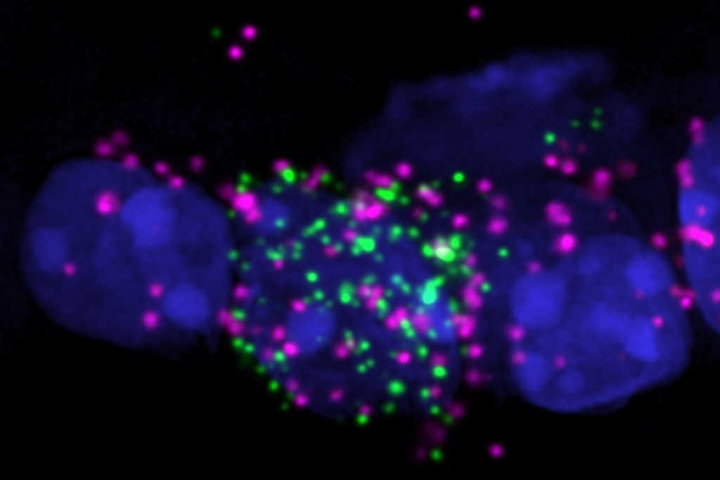 Retinal neuron surprise