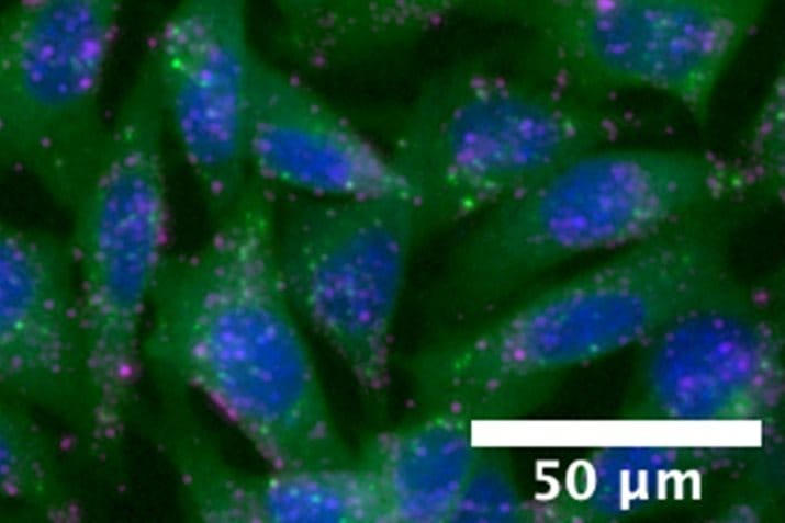 Glowing nanoparticle confirms drug delivery