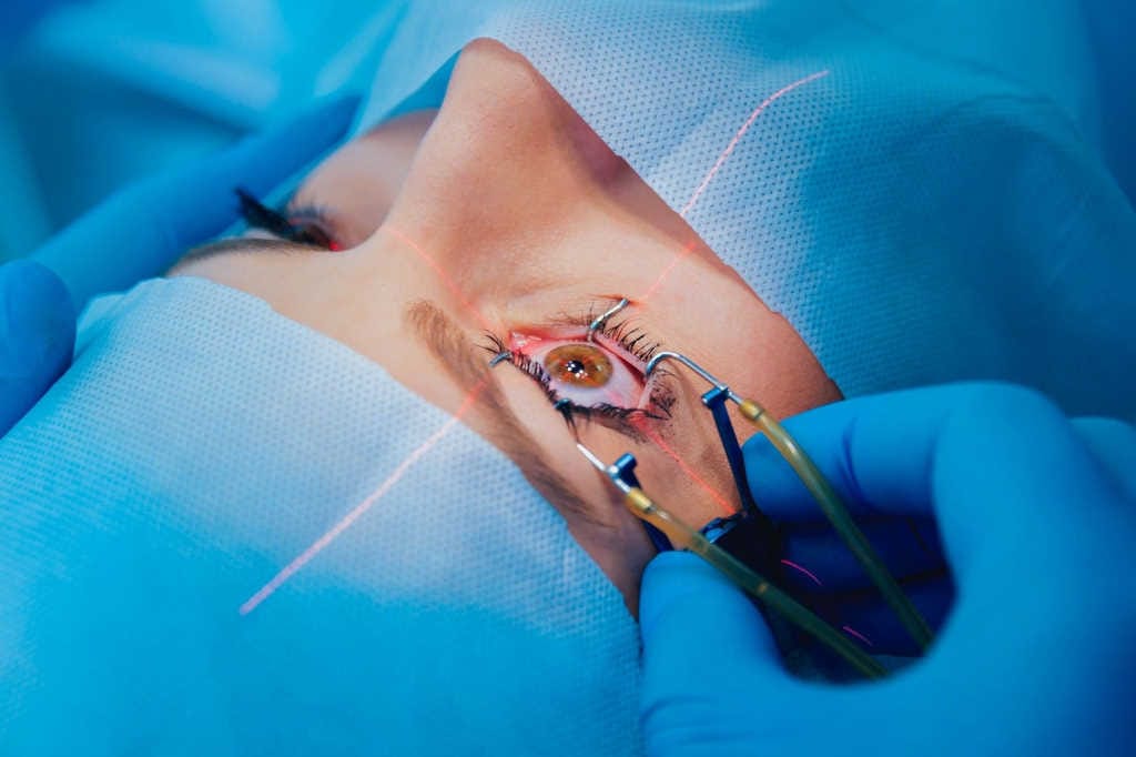 The fall and rise of refractive surgery