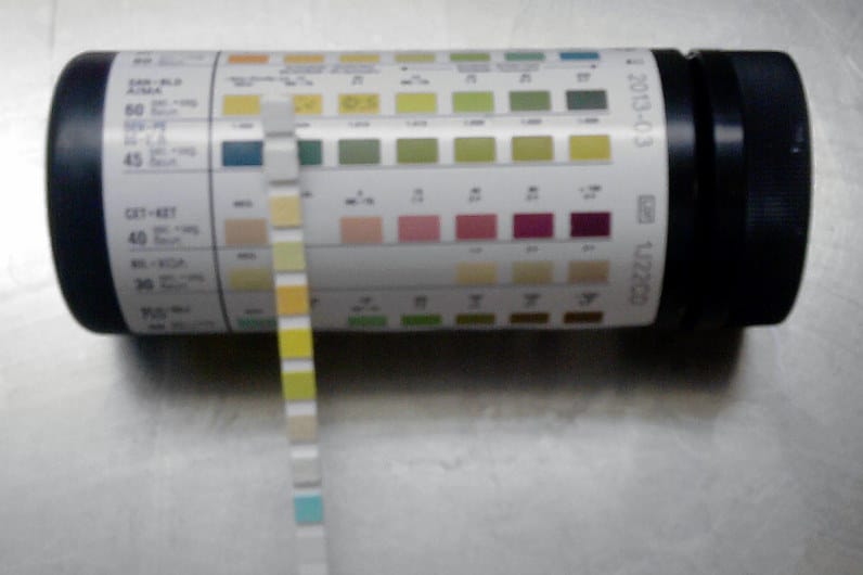 Urine test for river blindness