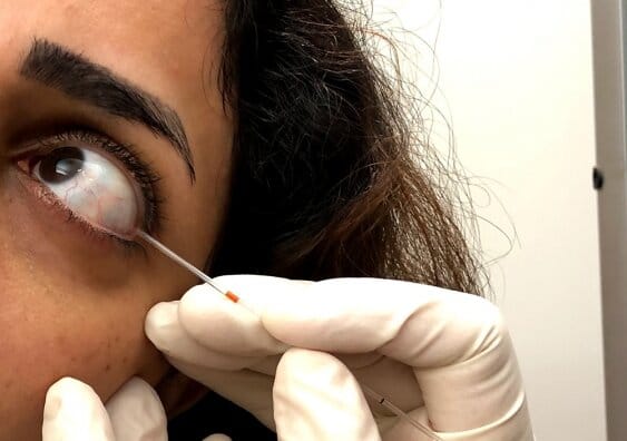 Tear test screening for diabetes complications