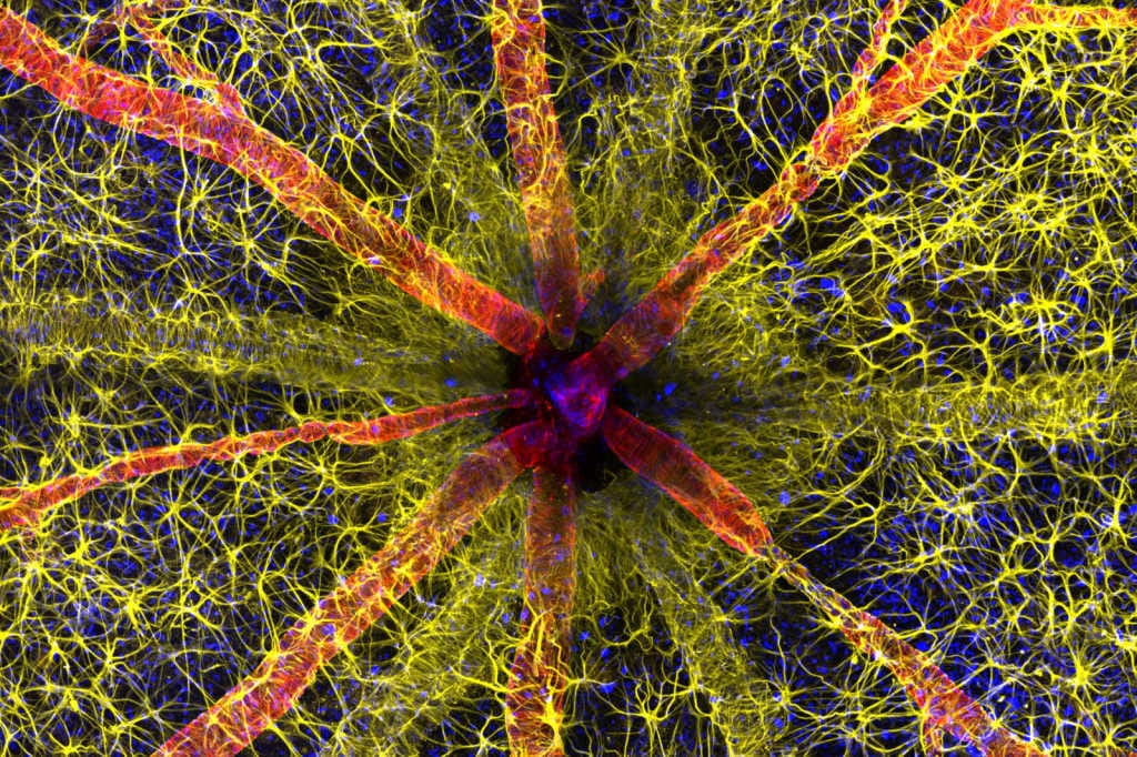 Global win for Australian retinal image (1)