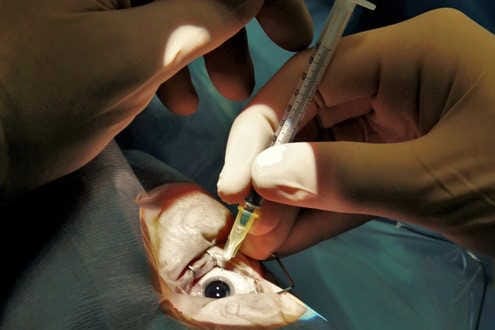 Trials advance for fewer injections