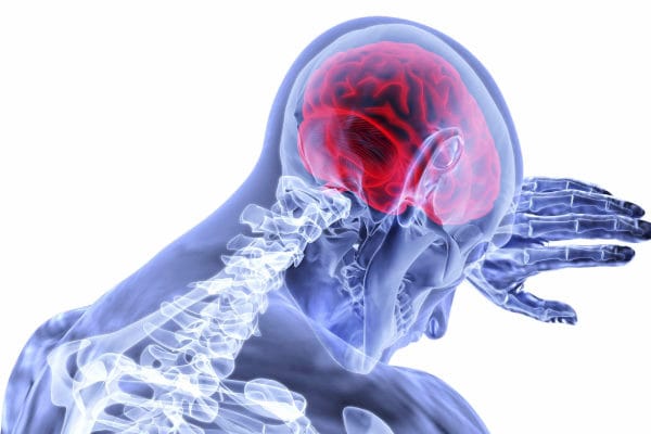 The visual impact of stroke