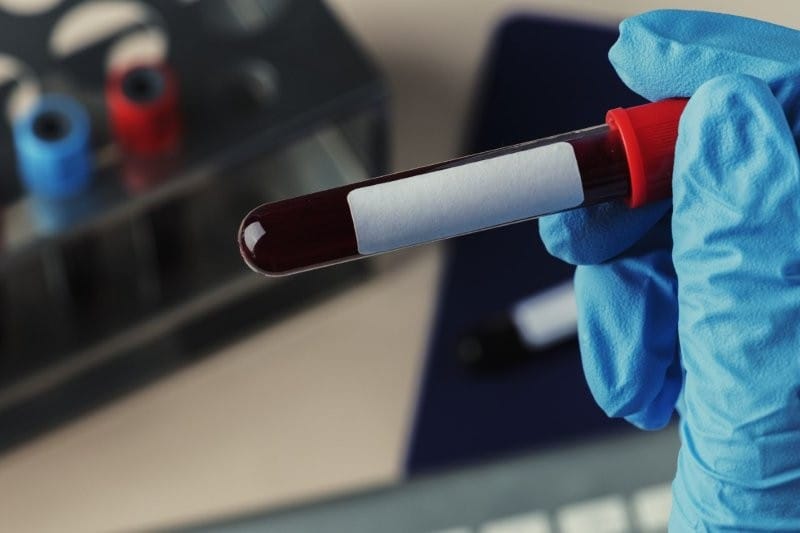 blood test tube small