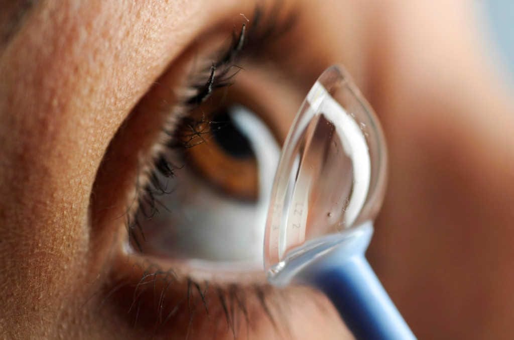 Wavefront-guided sclerals boost BCLVA