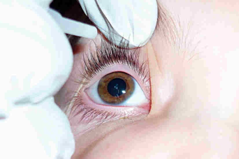 Bioelectricity boosts tear film