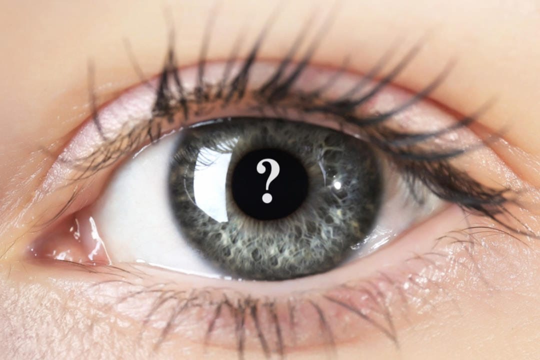 Case study: MS? NAAION? None of the above?
