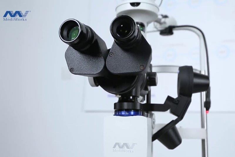 Optimed: Dry eye AI
